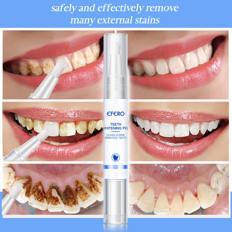 Instant Teeth Whitening Pen - NovaTech365